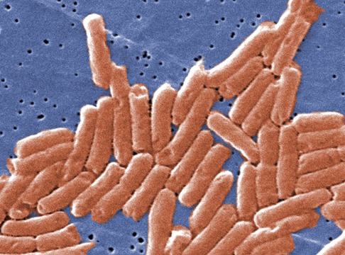 Canada also has an outbreak of Salmonella infections under investigation